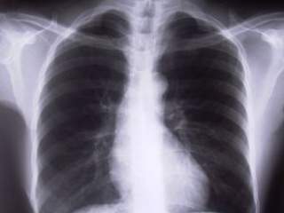 Da li pravilno dišemo? Pitanje koje ne postavljamo sebi često