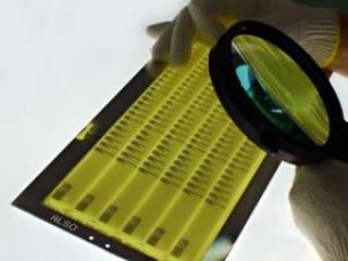 Veliki broj mikroorganizama može izazvati infekciju urinarnog trakta